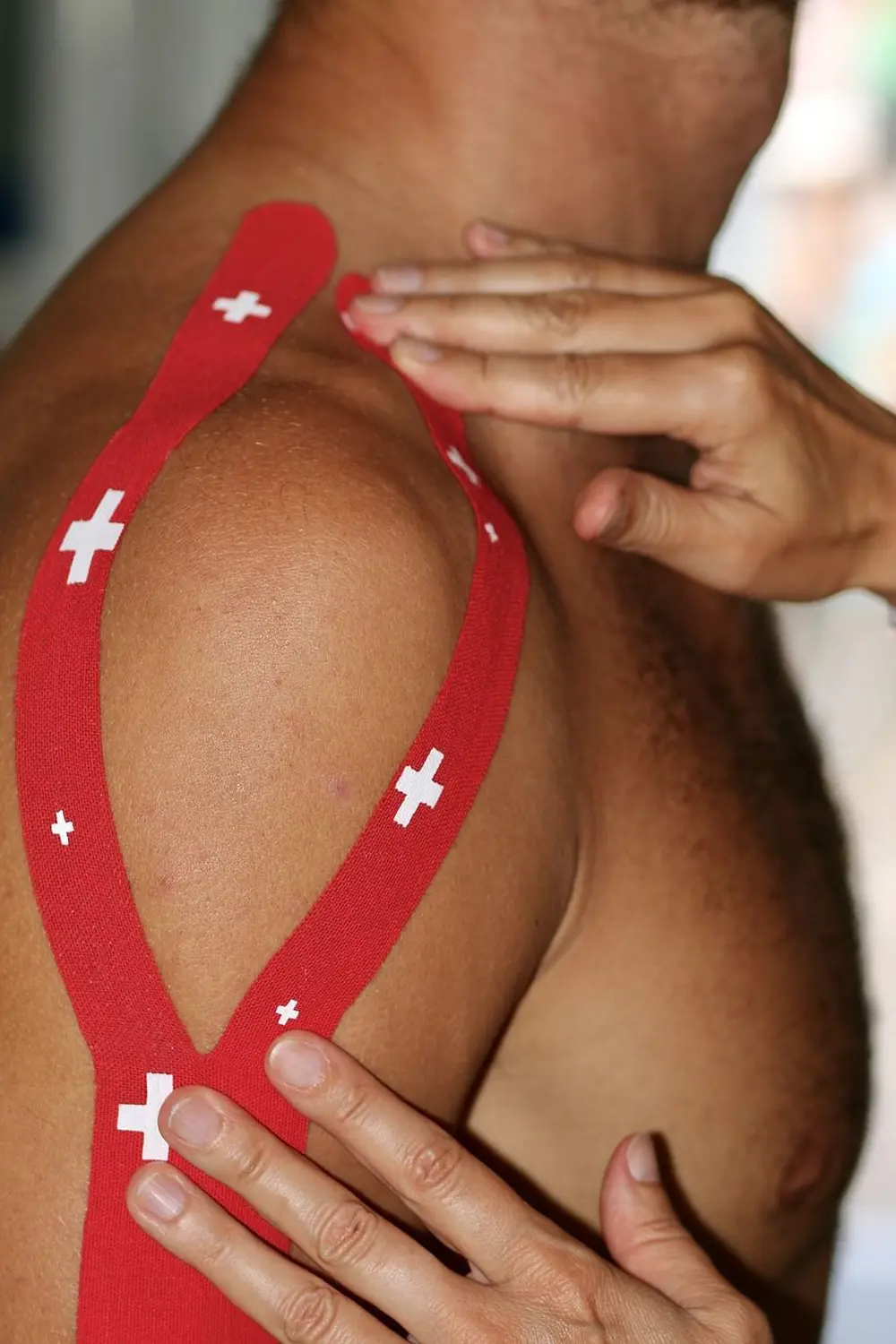 Ergotherapie Altstadt Spandau, Rote Bandagierung der Schulter